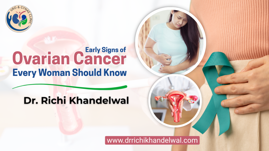 Early Signs of Ovarian Cancer