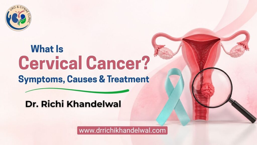cervical cancer